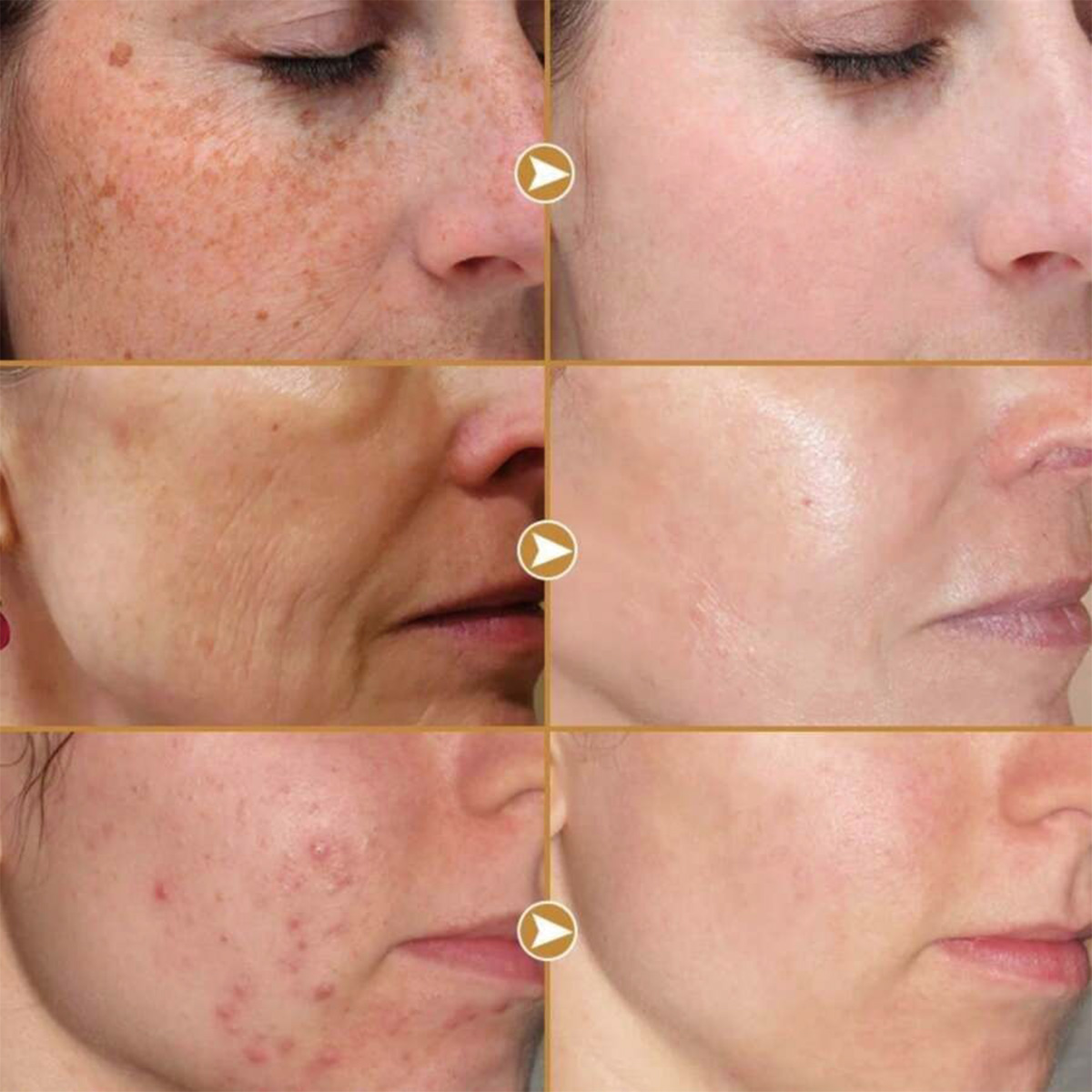 TRSTAY Krim Leher Wajah Esensi - Peptide Neck Cream ulasan dan harga